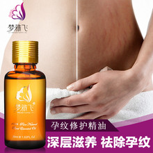 马拉松黑话中兔子叫什么