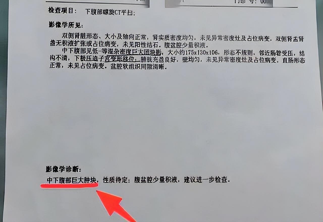 体检报告出现这3个“字眼”，多半是肺癌前兆！建议立刻就医